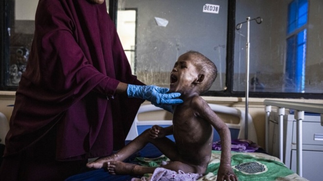 πείνα-στη-σομαλία-730-παιδιά-πέθαναν-μέσ-59883