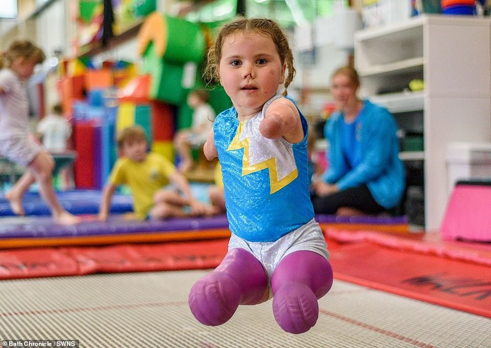 10 μηνών έχασε χέρια και πόδια από μηνιγγίτιδα, στα 7 της χρόνια πήρε χρυσό στην ενόργανη - εικόνα 1