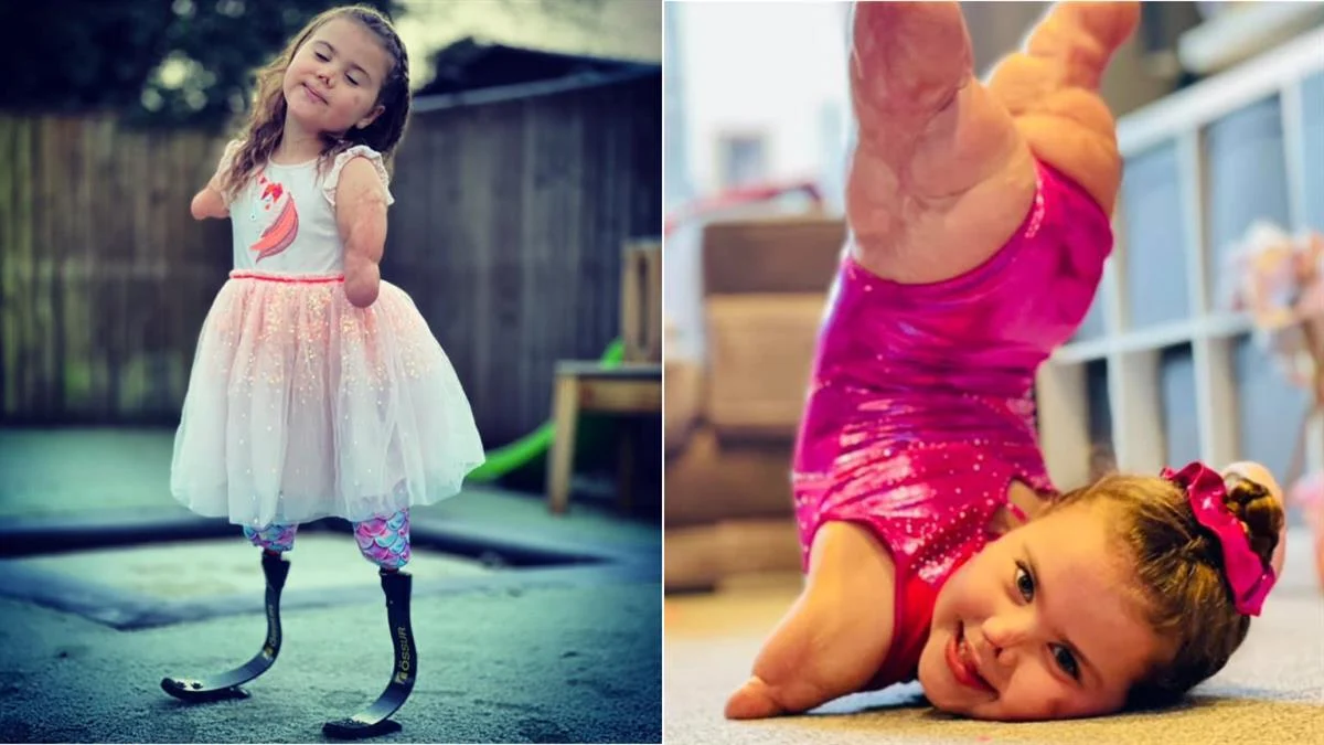 10 μηνών έχασε χέρια και πόδια από μηνιγγίτιδα, στα 7 της χρόνια πήρε χρυσό στην ενόργανη