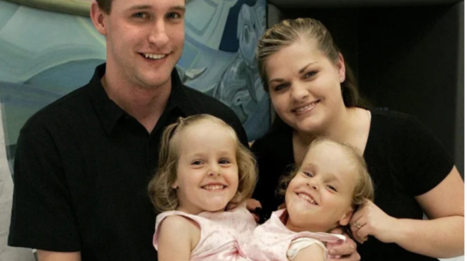 to-2002-γεννήθηκαν-δίδυμες-σιαμαίες-τις-χώρ-67489