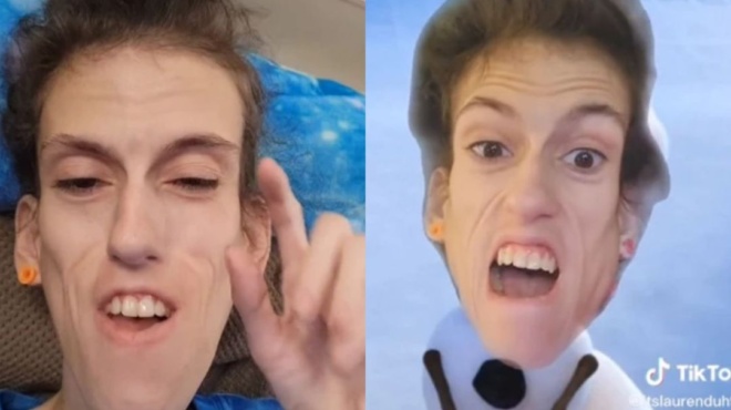 27χρονη-με-σπάνια-πάθηση-απαντά-στα-απαρ-95828