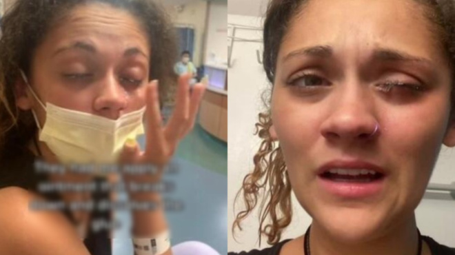 μπέρδεψε-το-κολλύριο-με-σούπερ-κόλλα-η-87209