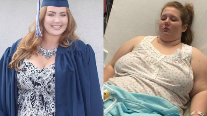 υπέρβαρη-18χρονη-πήρε-την-απόφαση-να-χάσ-94344