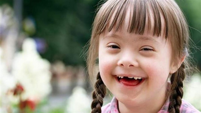 παιδιά-με-σύνδρομο-down-δεν-με-λένε-μογκο-82549