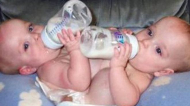 σπάνιες-σιαμαίες-δίδυμες-γεννήθηκαν-107375