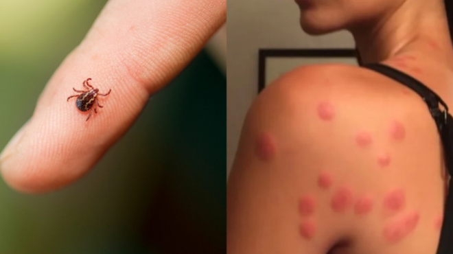 τσιμπούριακοριοί-και-ακάρεα-πως-θα-αν-97010