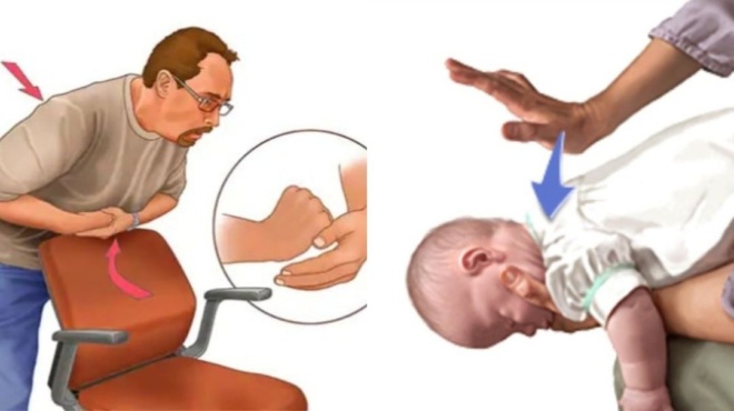 η-λαβή-heimlich-και-οι-κινήσεις-που-πρέπει-να-ξ-104575