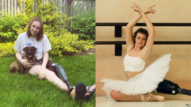 δύναμη-ψυχής-21χρονη-χορεύτρια-συνέχισ-116787