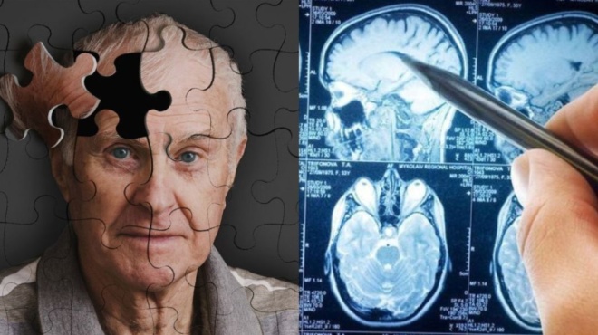 άνοια-τα-πρώτα-αθώα-προειδοποιητικ-131248