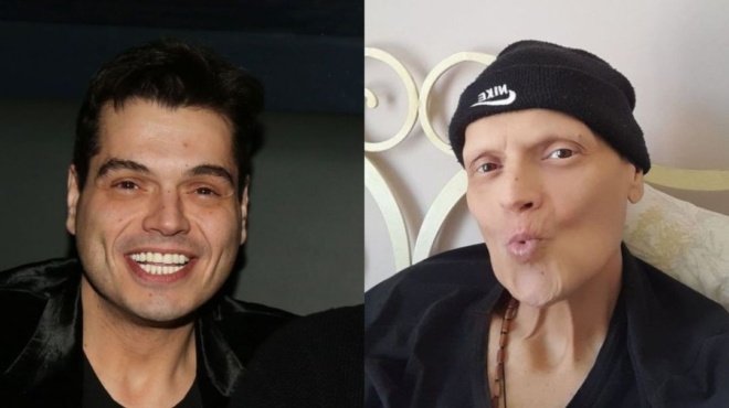 πως-θα-τραγουδήσεις-έτσι-χωρίς-μαλλι-149011