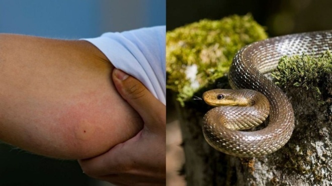 πόσα-είναι-τα-δηλητηριώδη-φίδια-στην-ε-154950