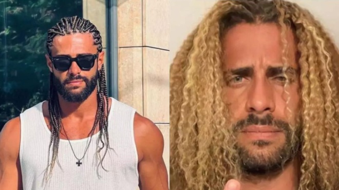 έχω-χάσει-όλα-μου-τα-μαλλιά-ο-κωνσταν-168200