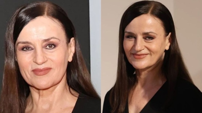 μεγαλώνει-φυσικά-χωρίς-επεμβάσεις-η-κ-174938