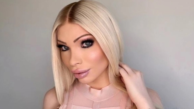 πλαστικές-επεμβάσεις-ξόδεψε-50-000-για-να-μ-183542