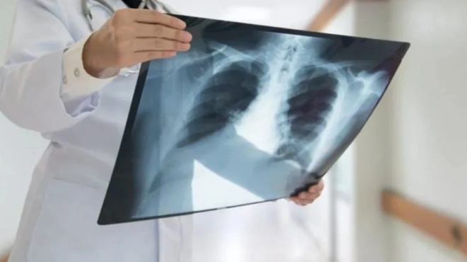 δίνει-ελπίδα-σε-ασθενή-στη-θεσσαλονίκ-202820