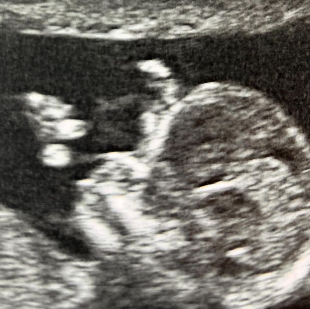 Ευρυδίκη Παπαδοπούλου