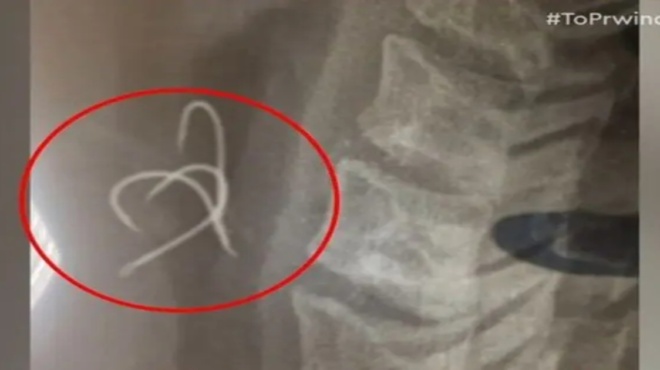 αγρίνιο-έγινα-μπλε-δεν-μπορούσα-να-πά-243867